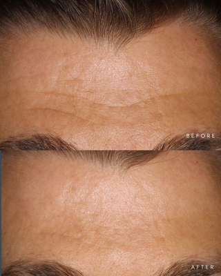 Anti-Aging Bundle