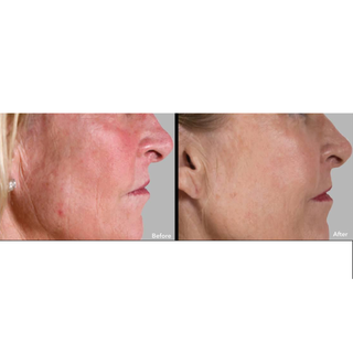 AnteAGE® System Serum & Accelerator