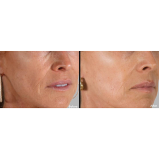 AnteAGE® System Serum & Accelerator