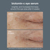 Biolumin-C Eye Serum