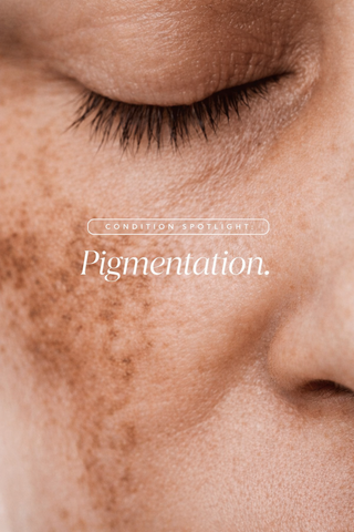 Pigmentation Bundle